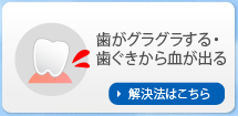 歯がグラグラする・歯ぐきから血が出る