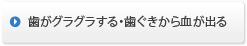 歯がグラグラする・歯ぐきから血が出る